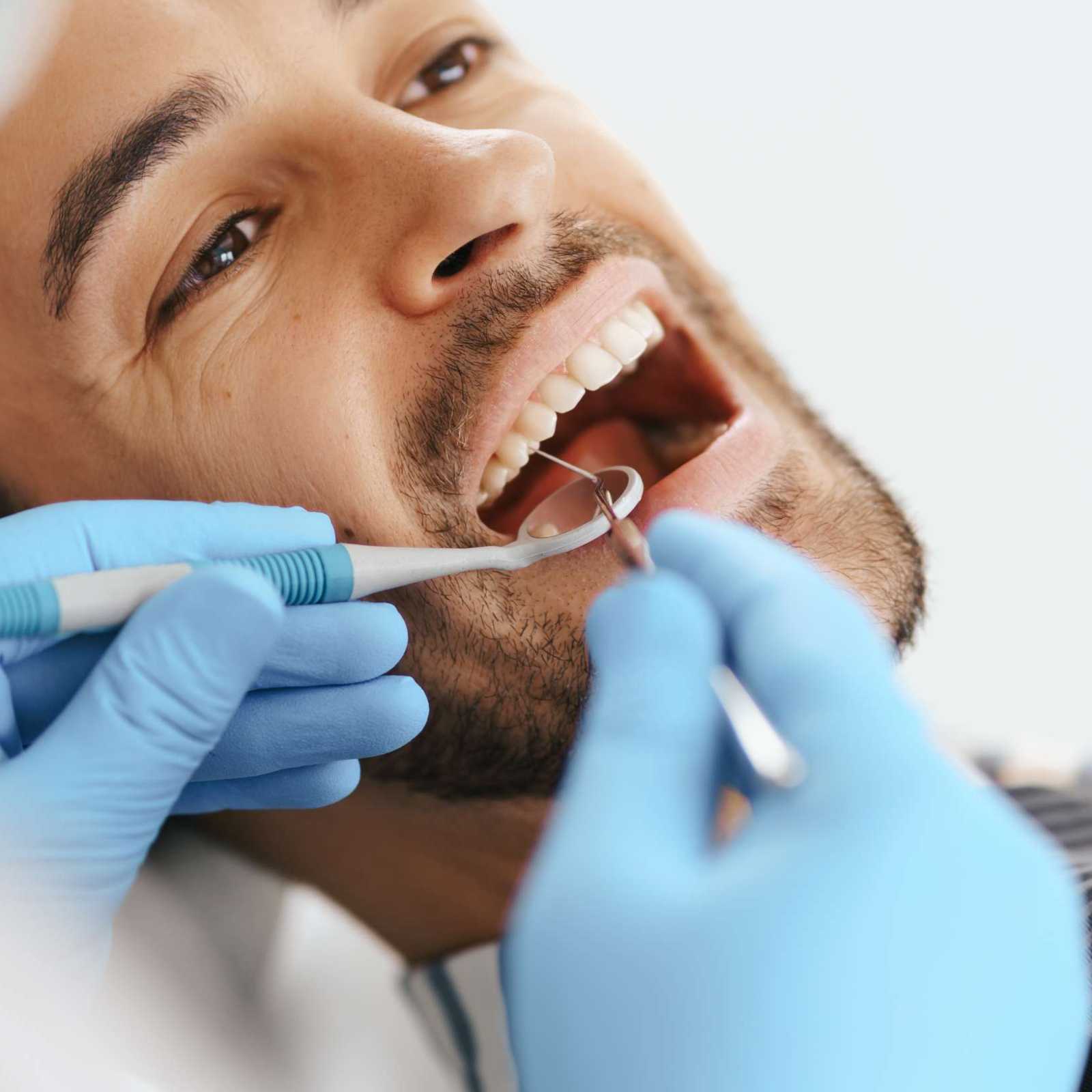 Prevenção e Limpeza (Profilaxia)